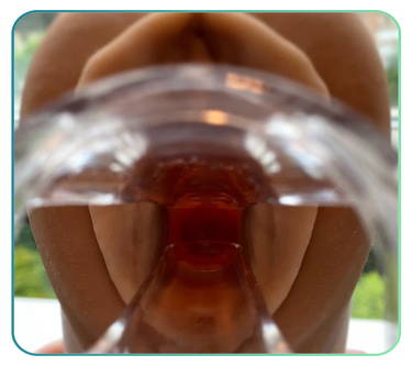 Cervical Screening / Smear Test Trainers