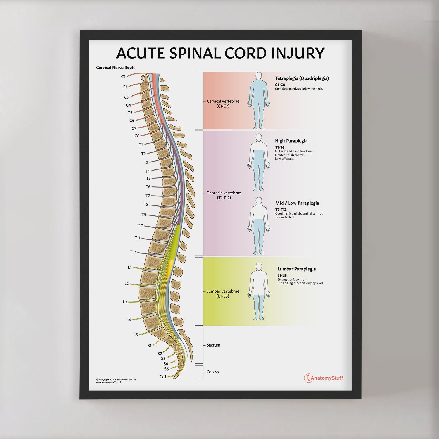 Acute Spinal Cord Injury Chart / Poster
