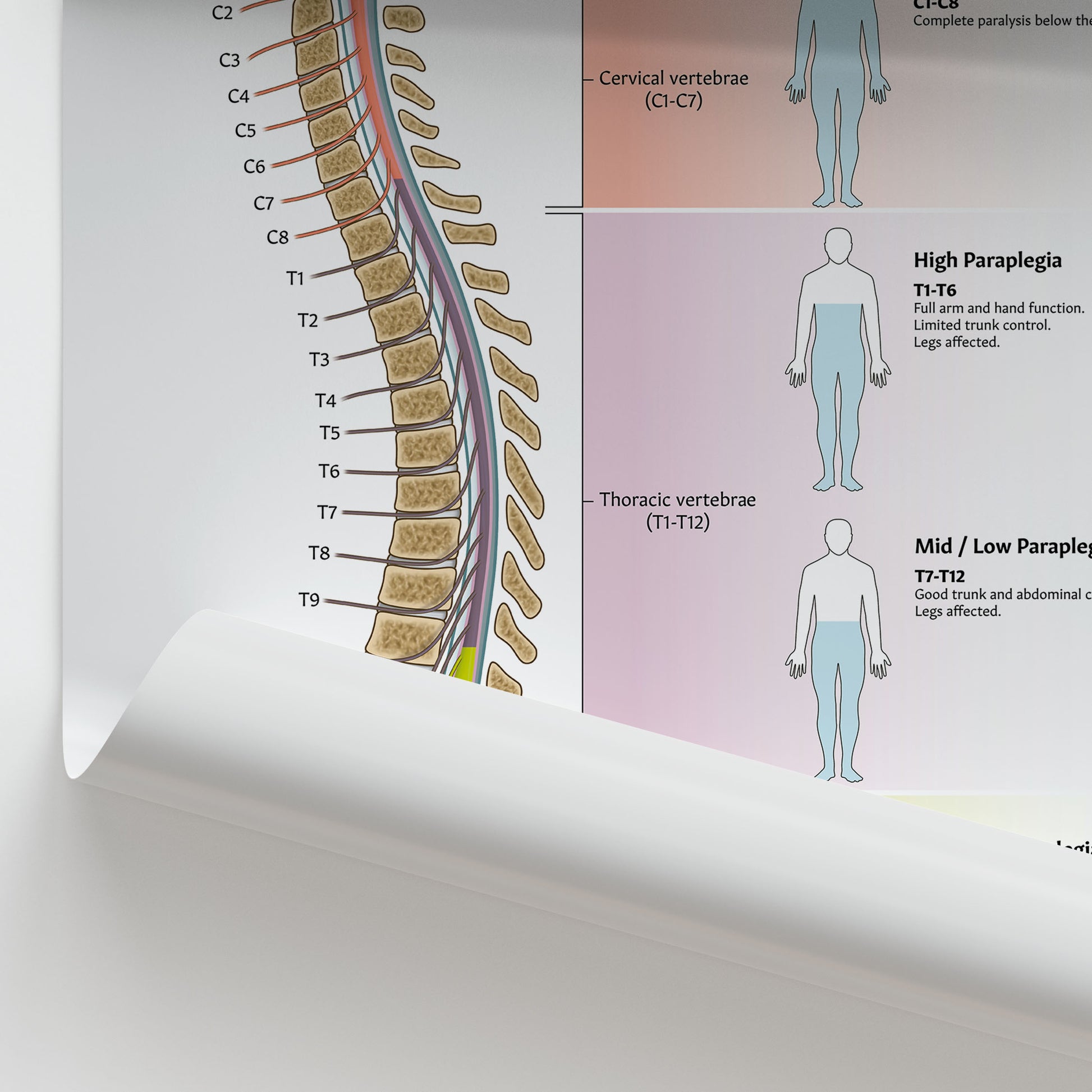 Acute Spinal Cord Injury Chart / Poster