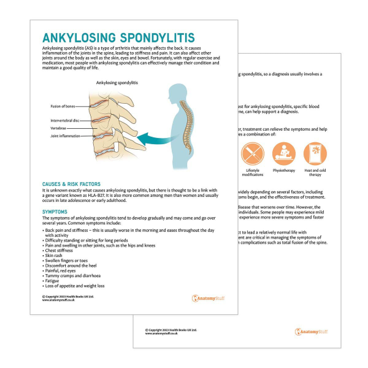 Ankylosing Spondylitis Patient Education Handout (Printable PDF)