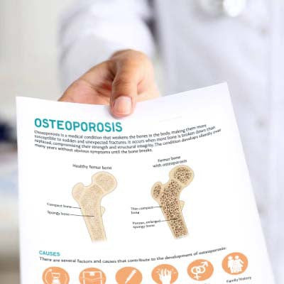 Osteoporosis Patient Education Handout (Printable PDF)