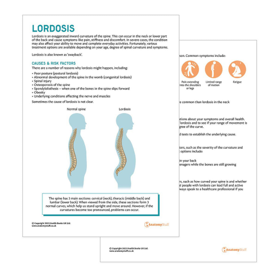 Lordosis Patient Education Handout (Printable PDF)