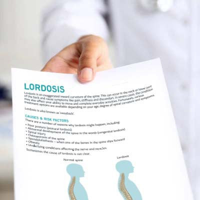 Lordosis Patient Education Handout (Printable PDF)