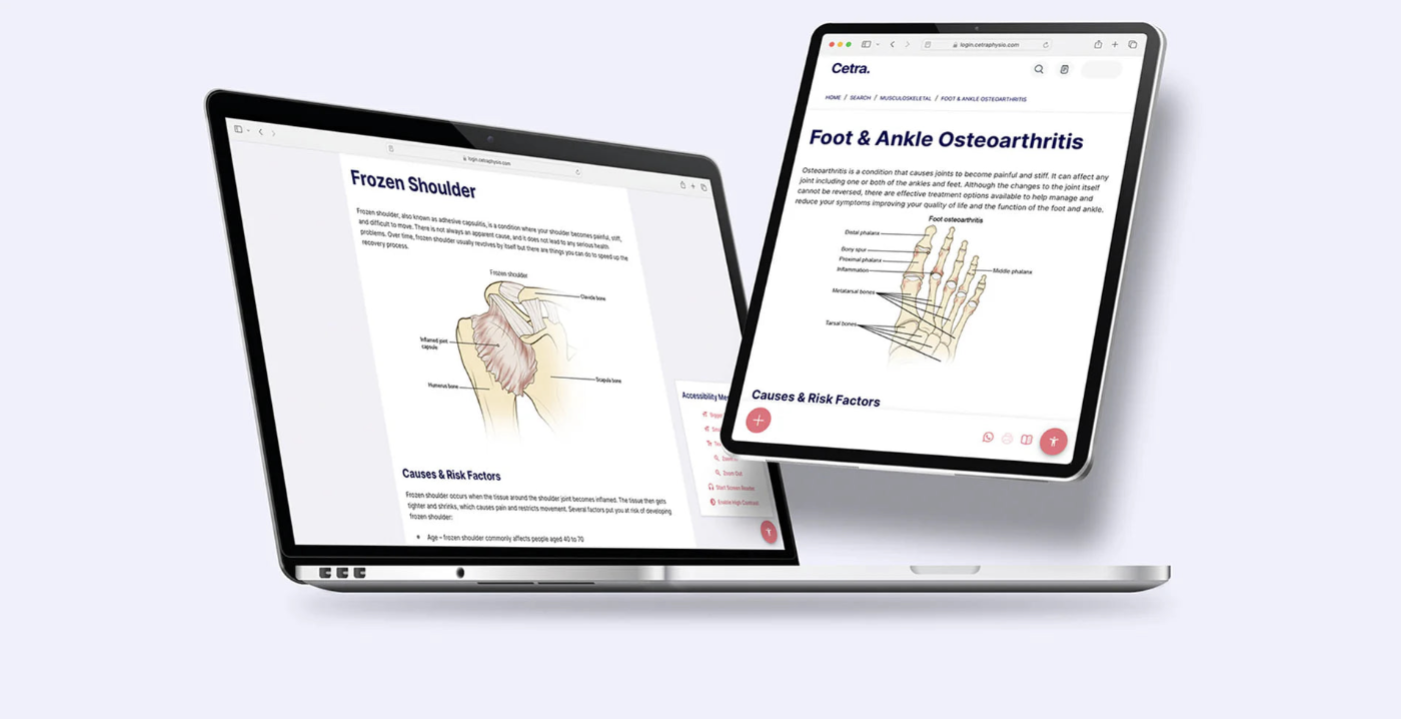 Search and share hundreds of medically written and reviewed patient education handouts on common MSK and health conditions.