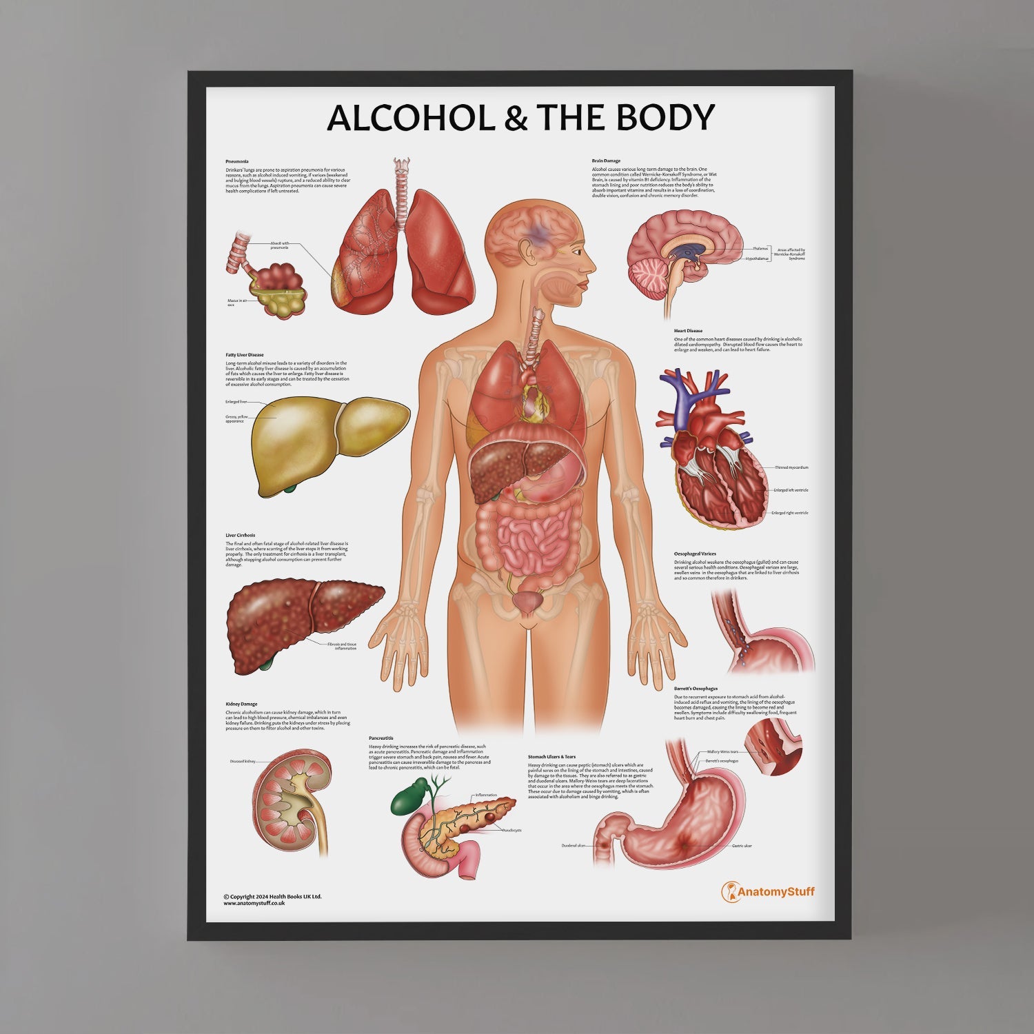 Alcohol and The Body Chart / Poster