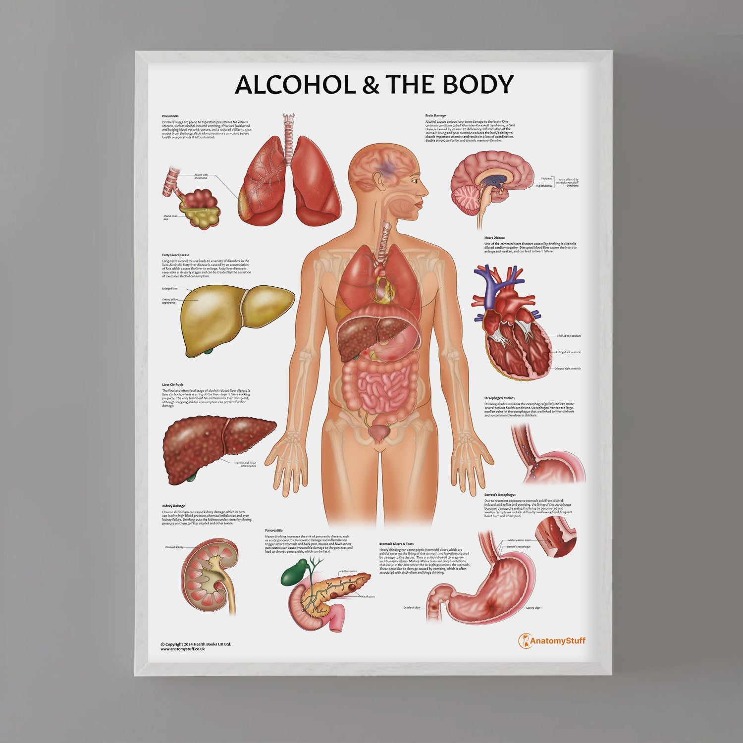 Alcohol and The Body Chart / Poster