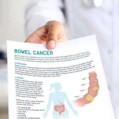 Bowel Cancer Patient Education Handout (Printable PDF)