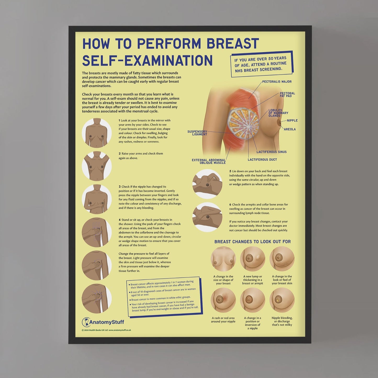 How to Perform Breast Self Examination (BSE) Chart / Poster
