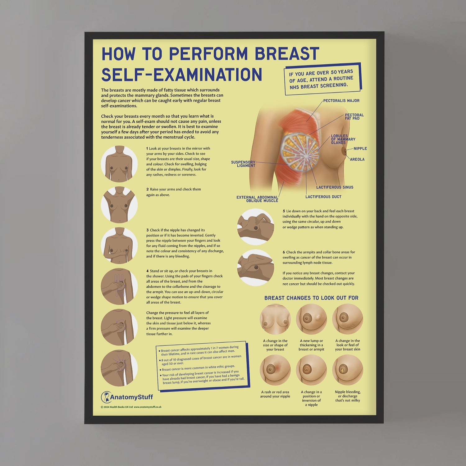 How to Perform Breast Self Examination (BSE) Chart / Poster