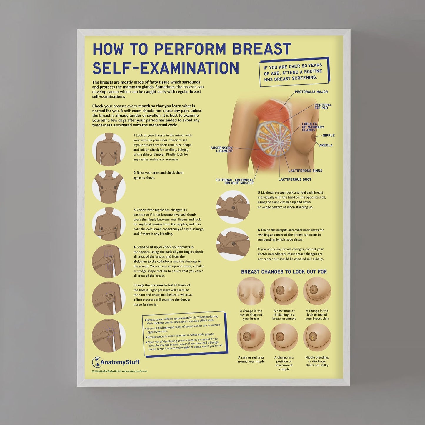 How to Perform Breast Self Examination (BSE) Chart / Poster