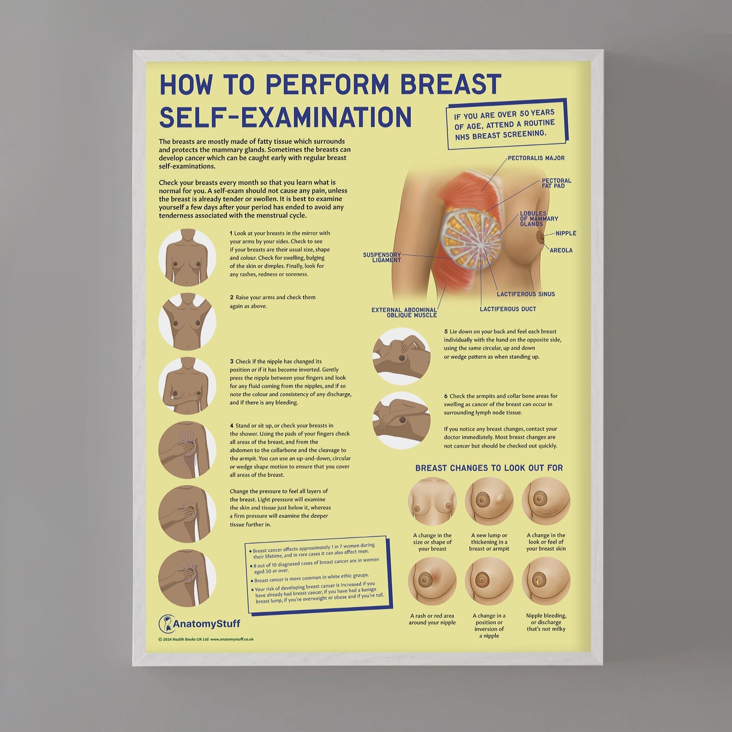How to Perform Breast Self Examination (BSE) Chart / Poster