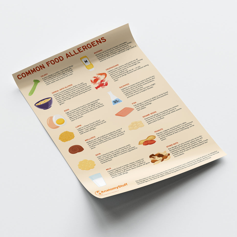 Common Food Allergens Chart / Poster
