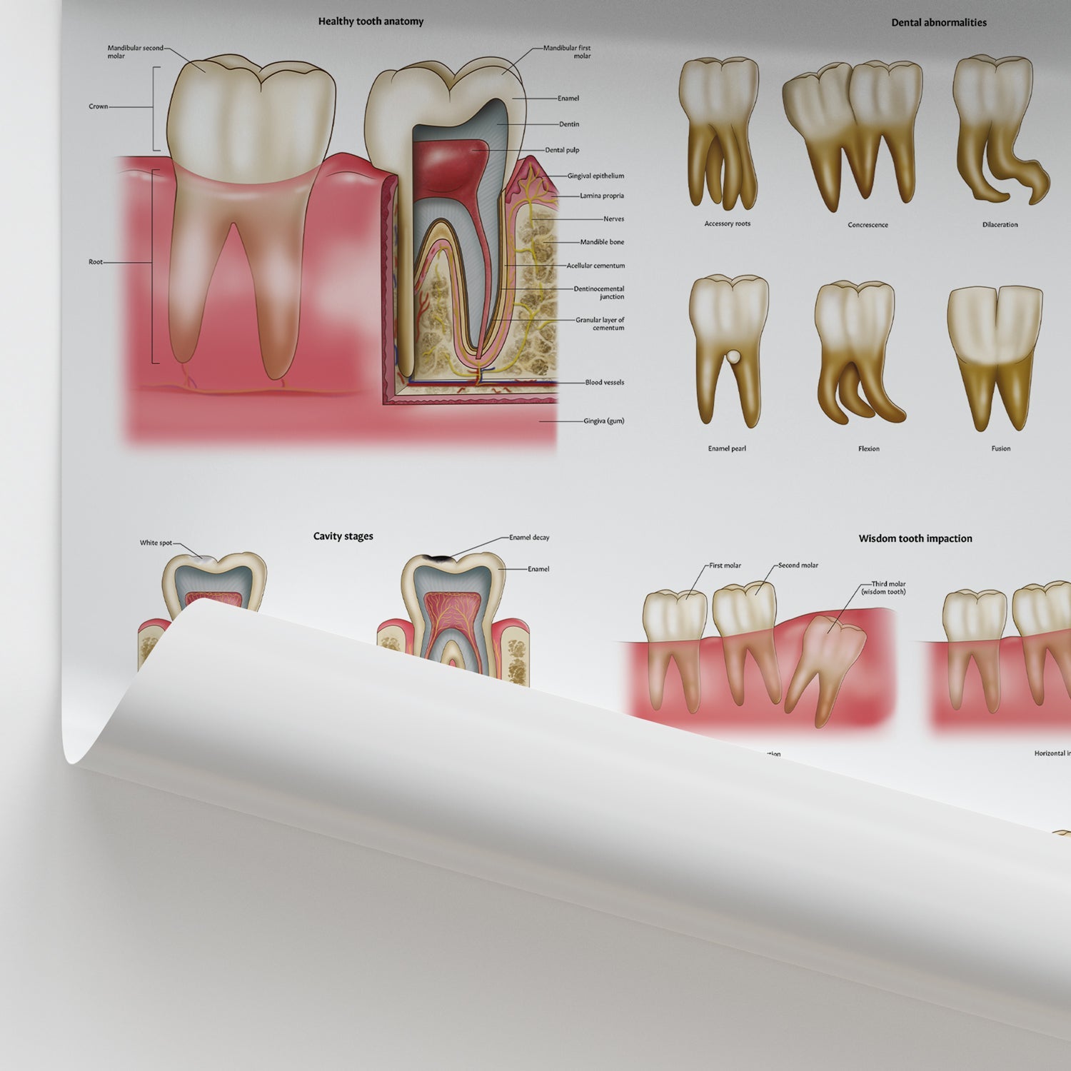 Dental Diseases & Disorders Chart / Poster