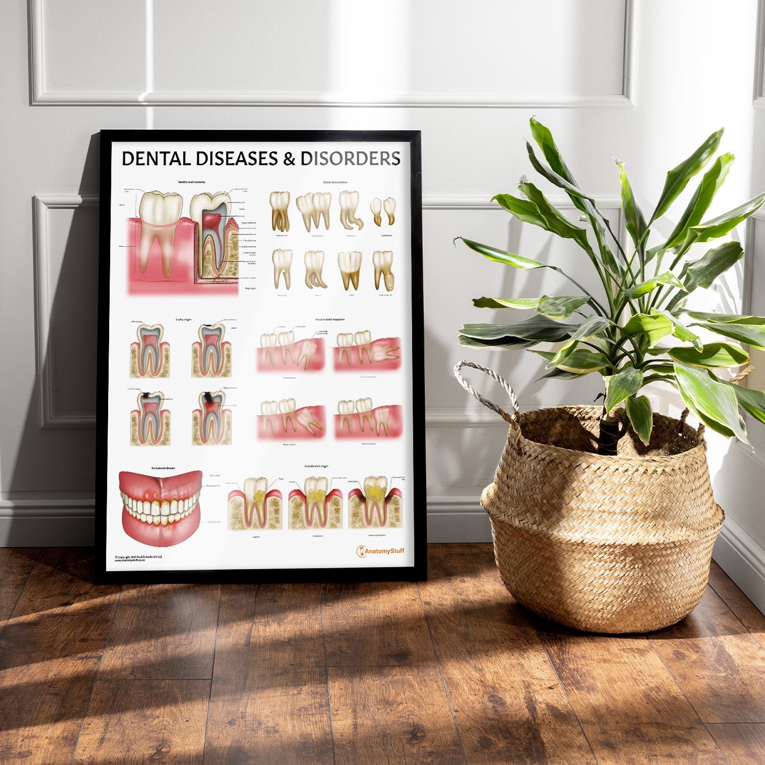 Dental Diseases & Disorders Chart / Poster