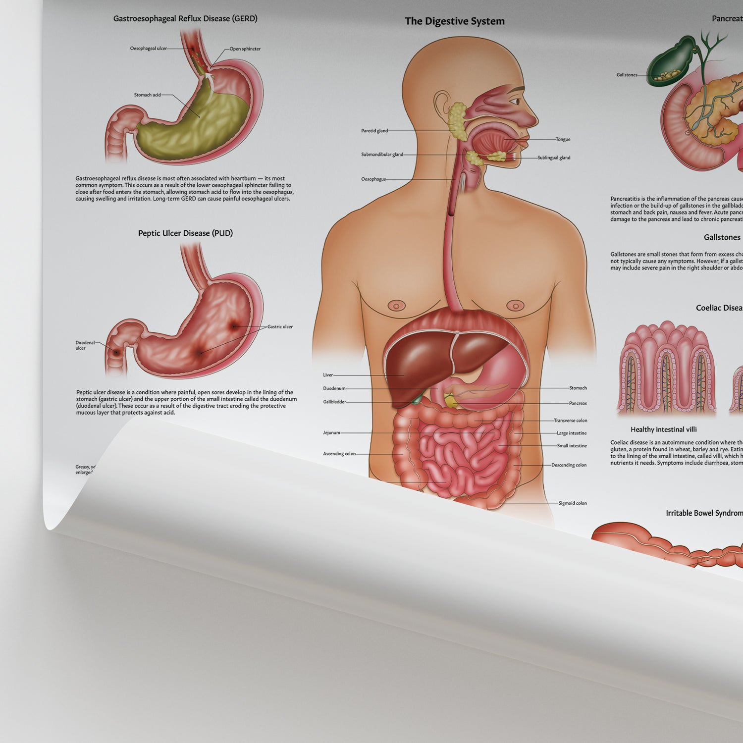 Diseases of the Digestive System Chart / Poster