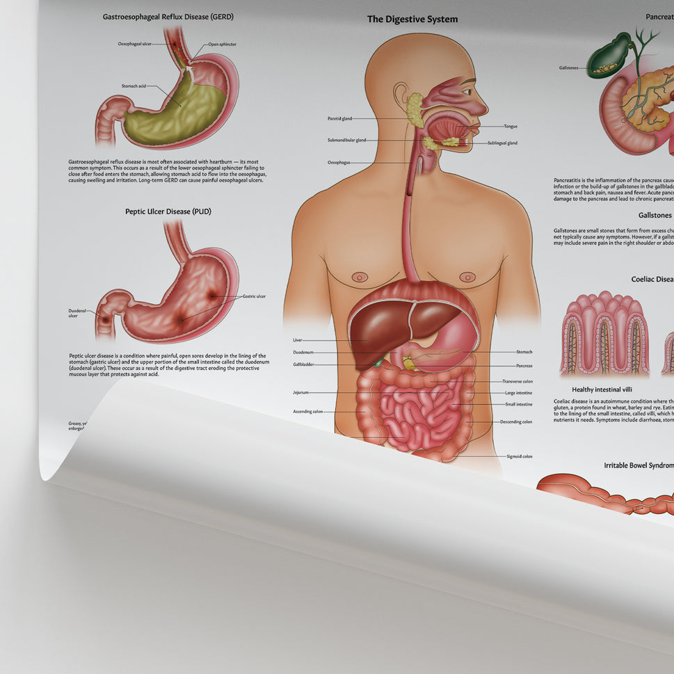 Diseases of the Digestive System Chart / Poster