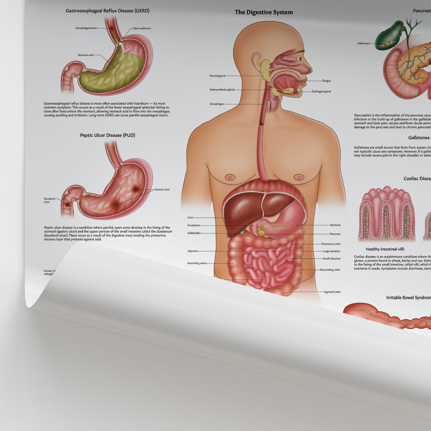 Diseases of the Digestive System Chart / Poster