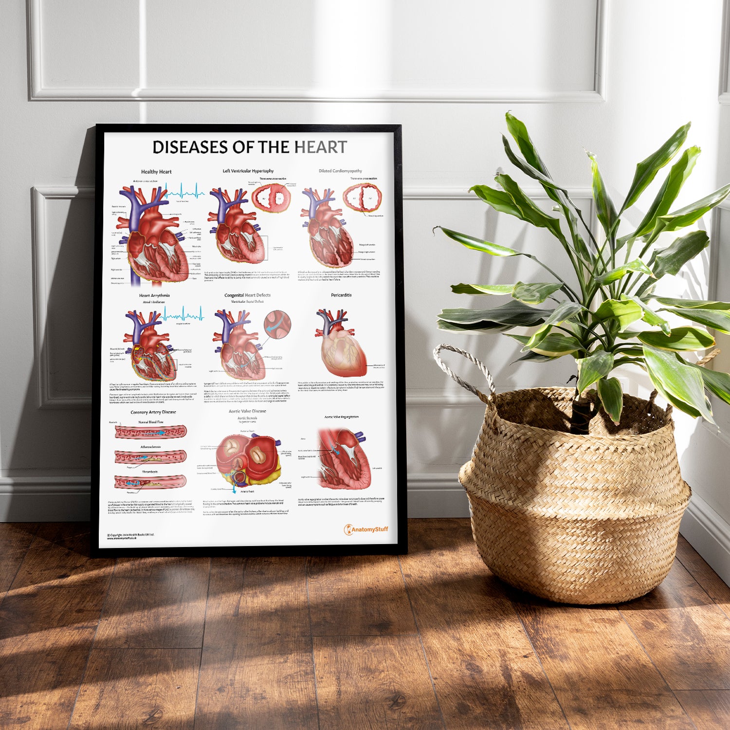 Diseases of the Heart Chart / Poster
