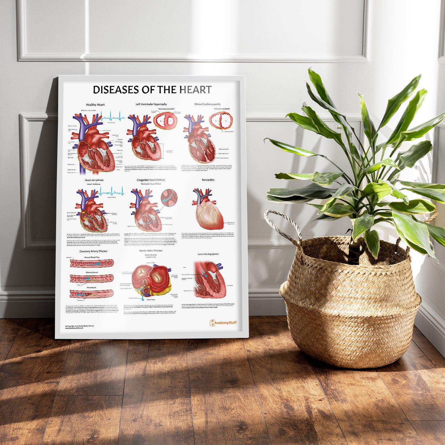 Diseases of the Heart Chart / Poster