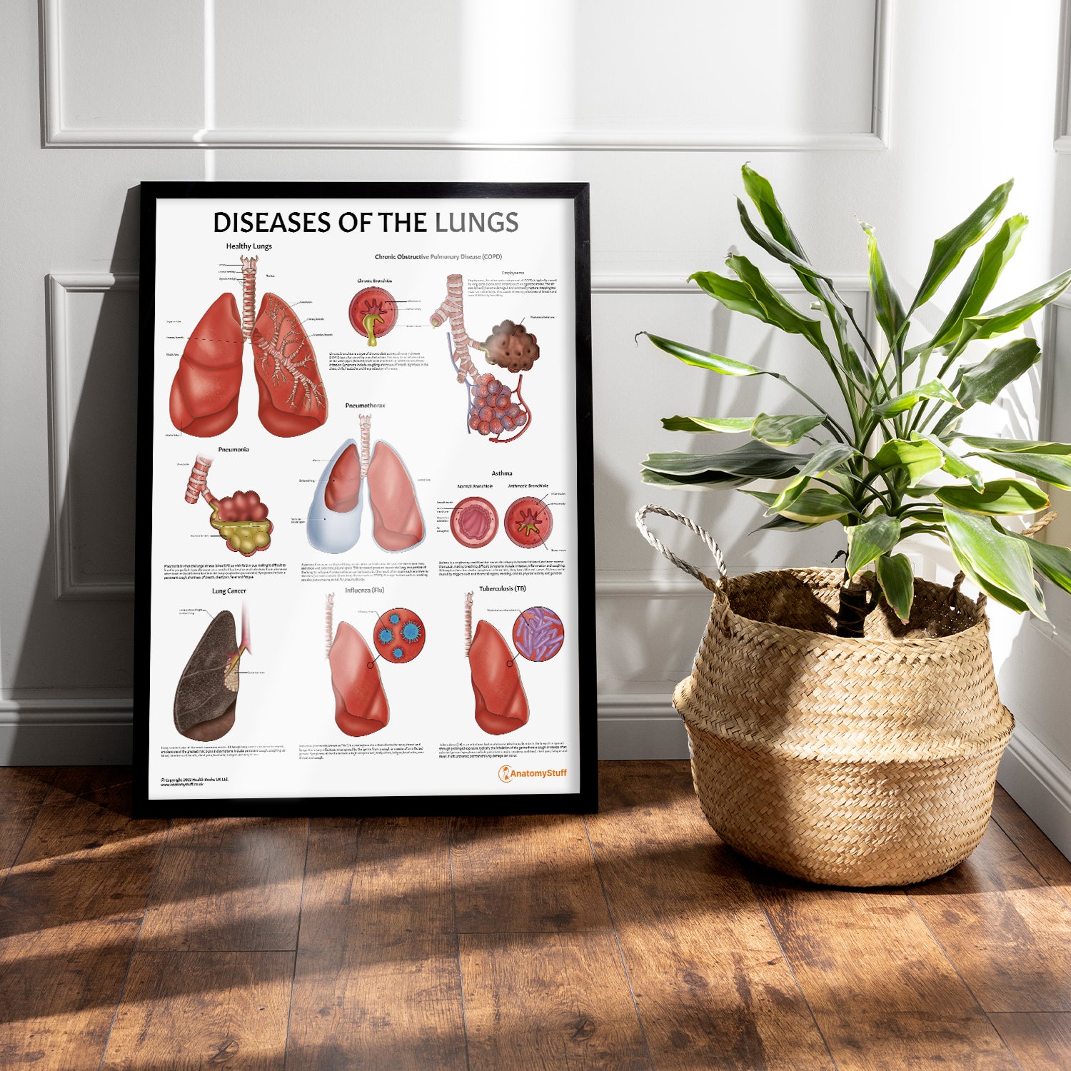 Diseases of the Lungs Chart / Poster