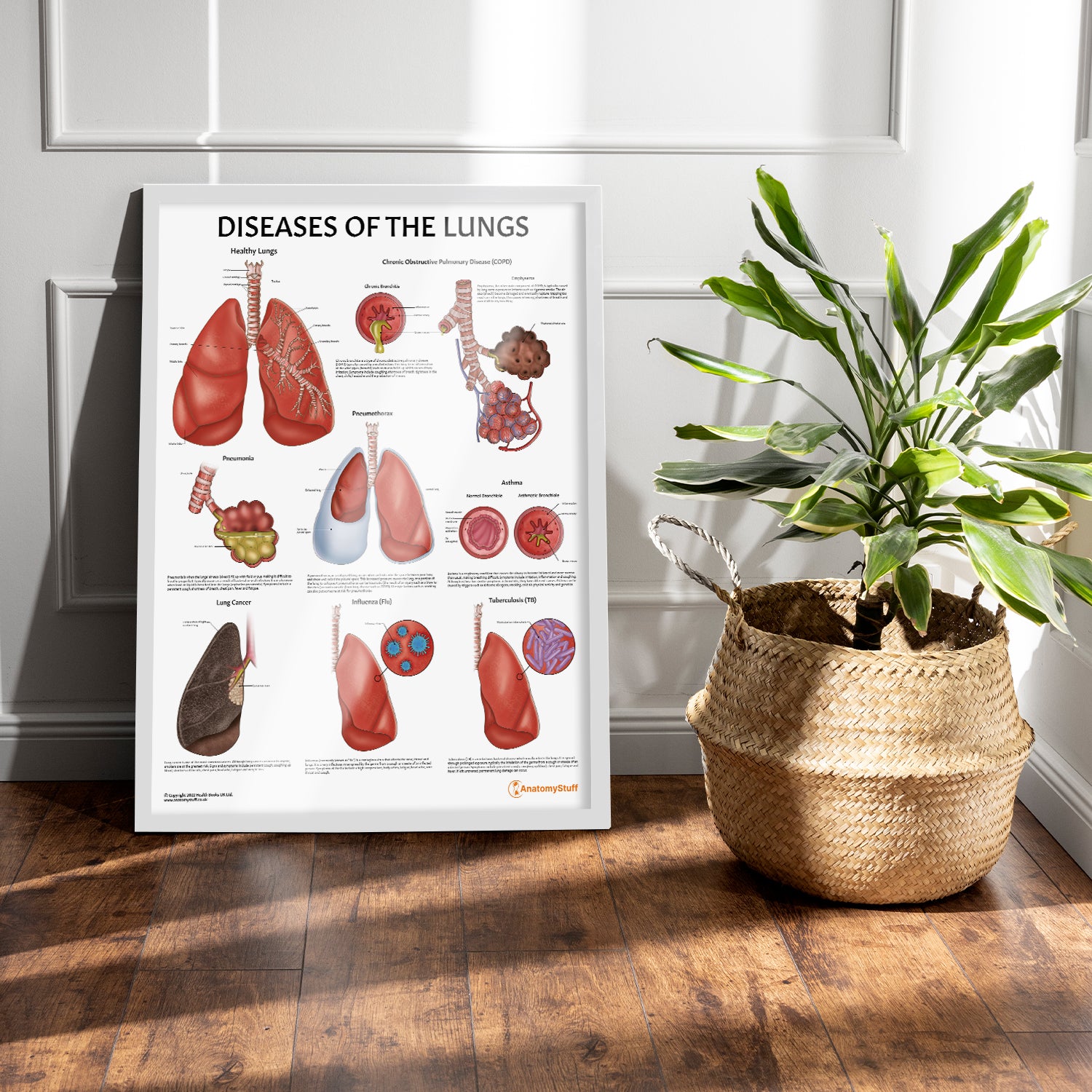 Diseases of the Lungs Chart / Poster