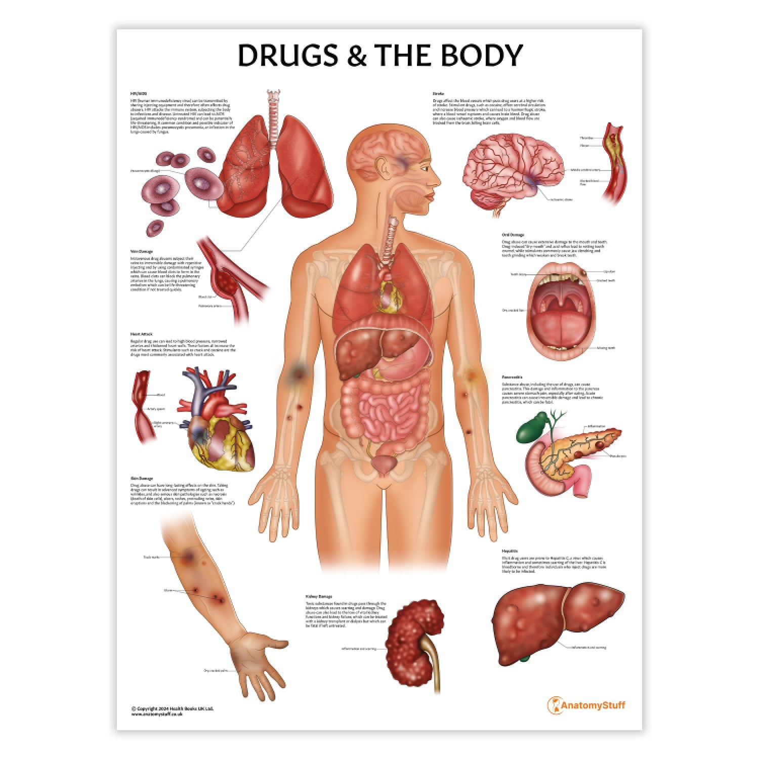 Drugs and The Body Chart / Poster