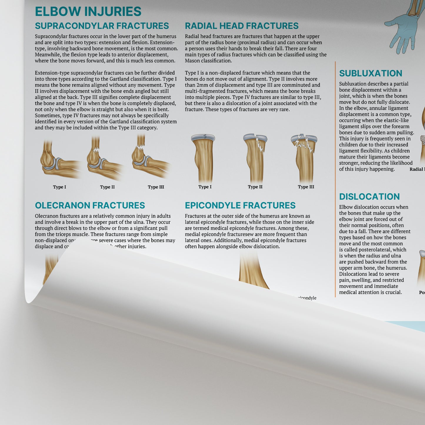 Injuries & Conditions of the Elbow Chart / Poster