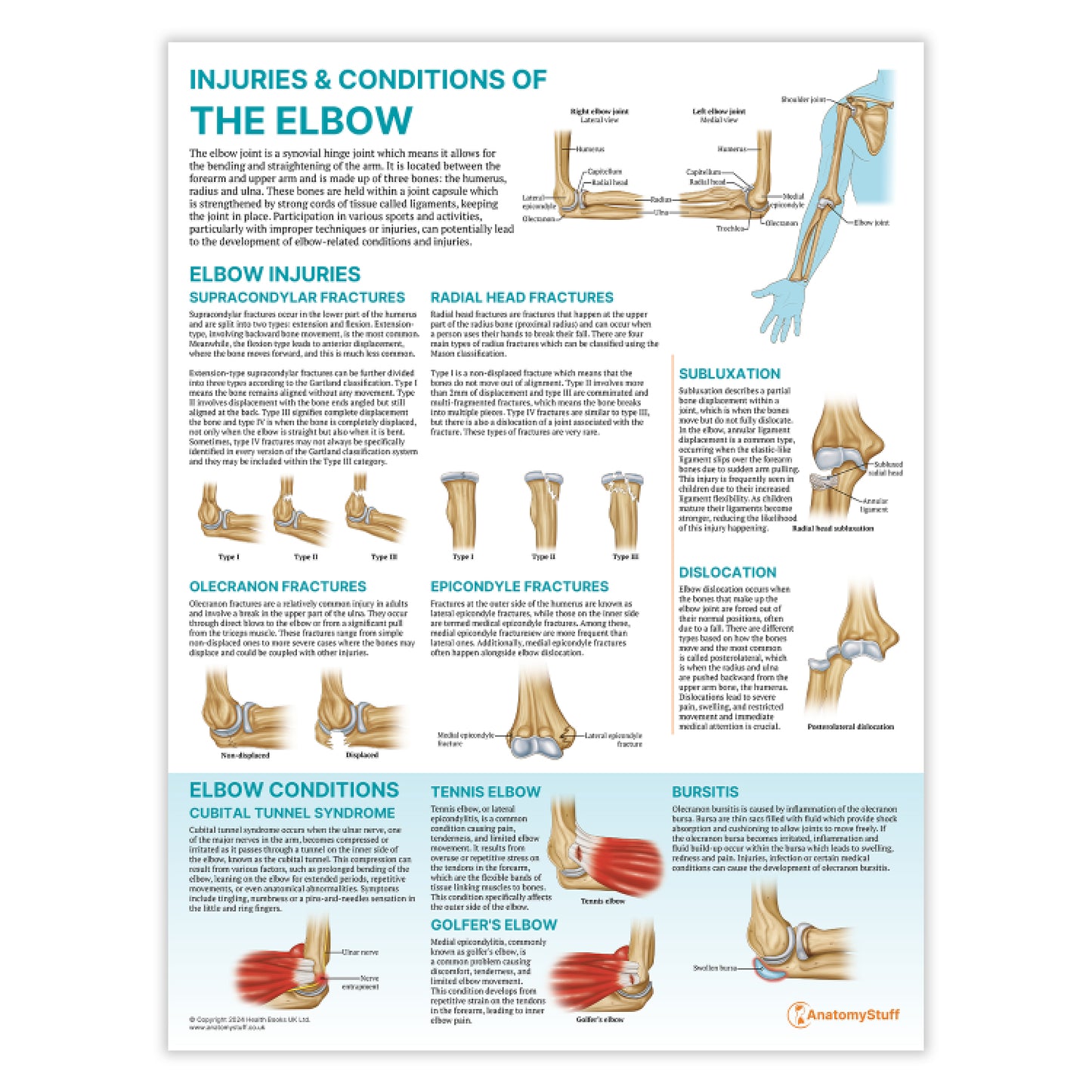 Injuries & Conditions of the Elbow Chart / Poster
