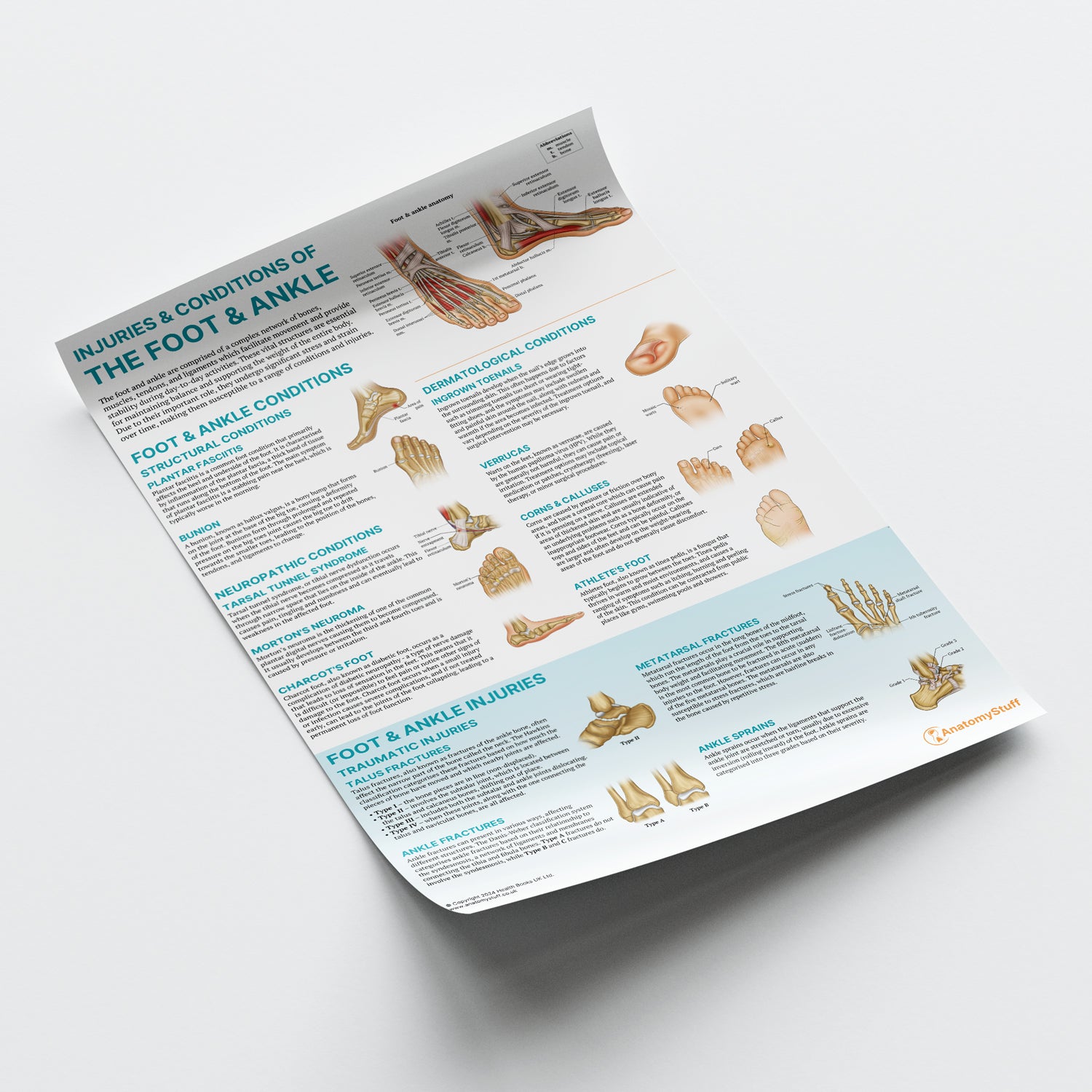 Injuries & Conditions of the Foot & Ankle Chart / Poster