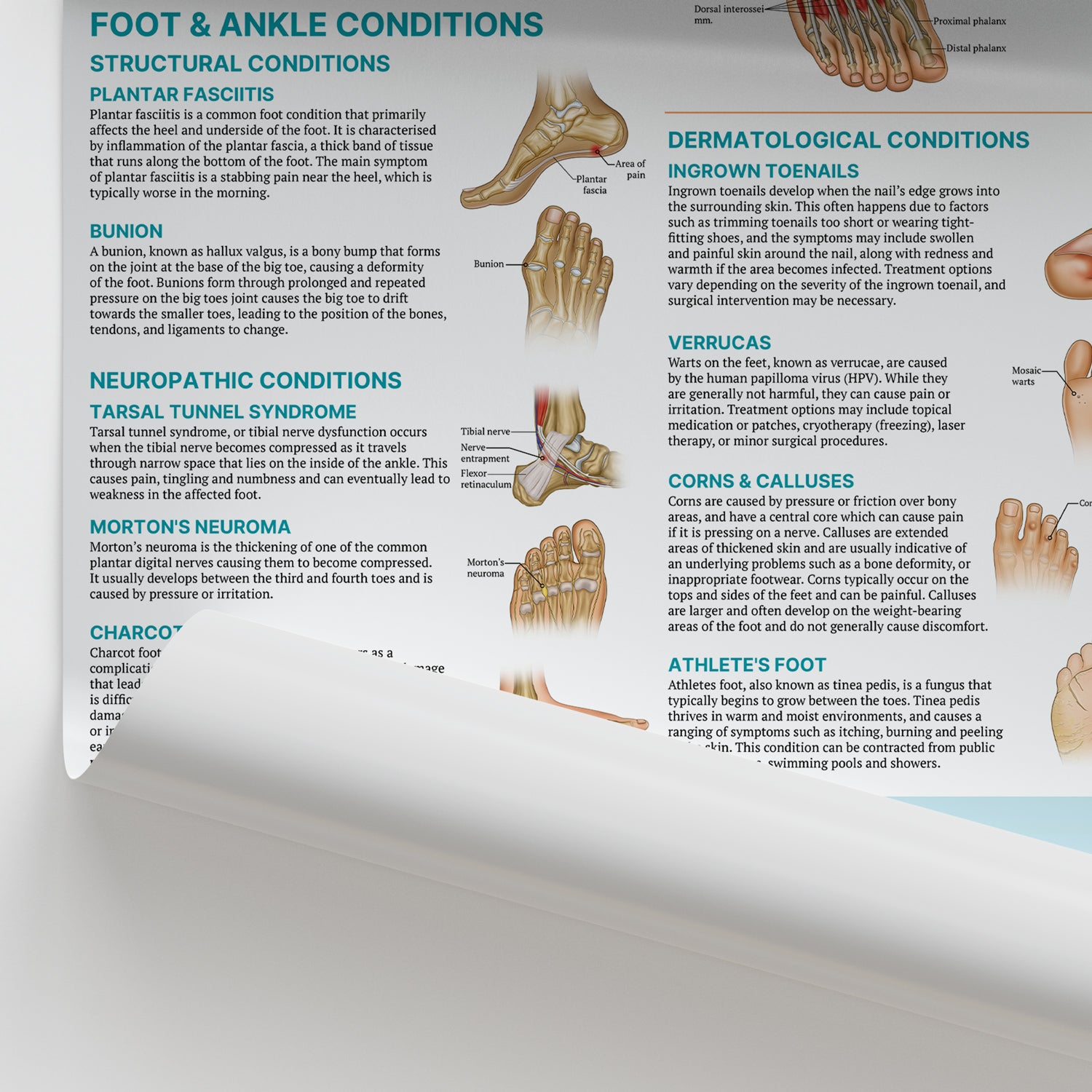 Injuries & Conditions of the Foot & Ankle Chart / Poster