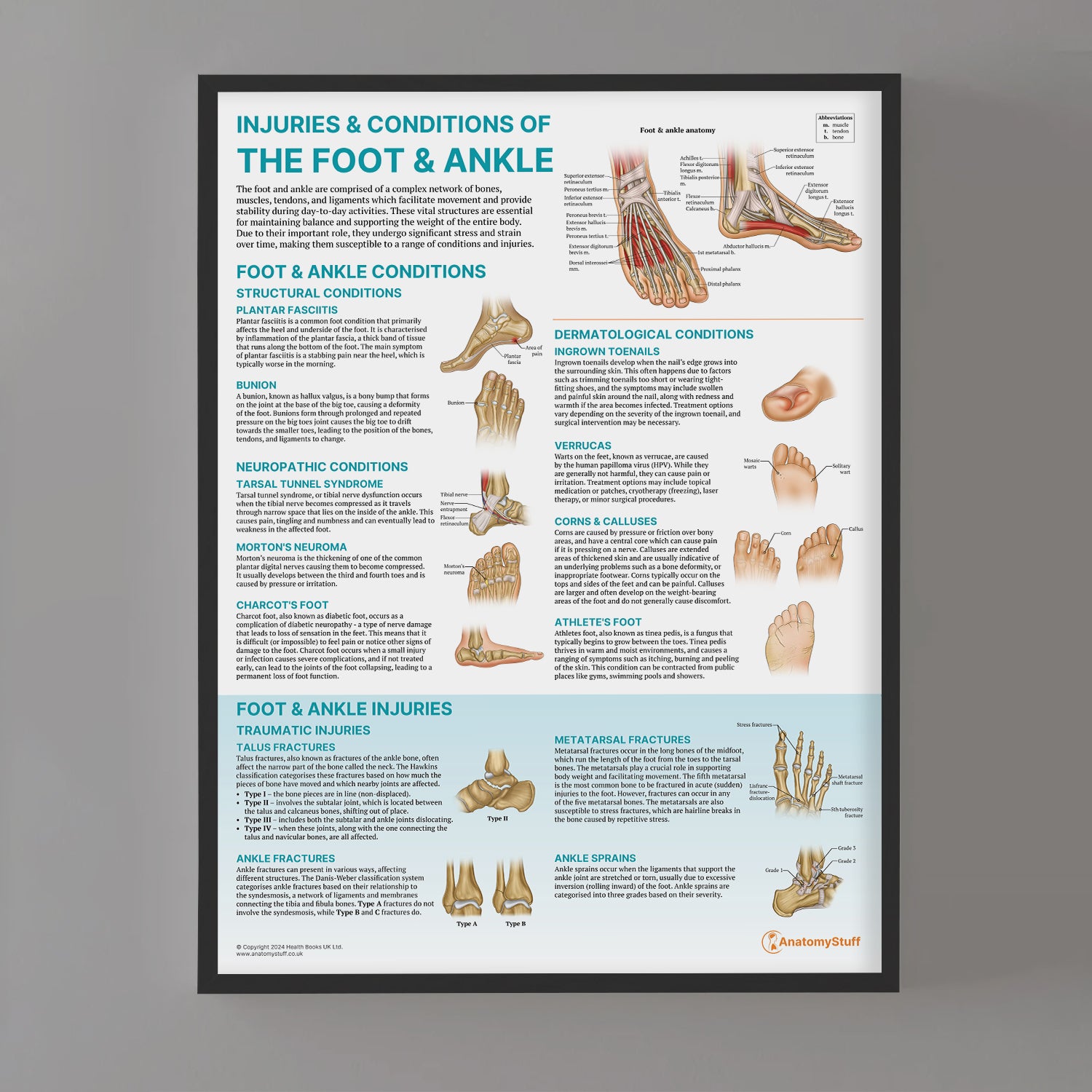Injuries & Conditions of the Foot & Ankle Chart / Poster