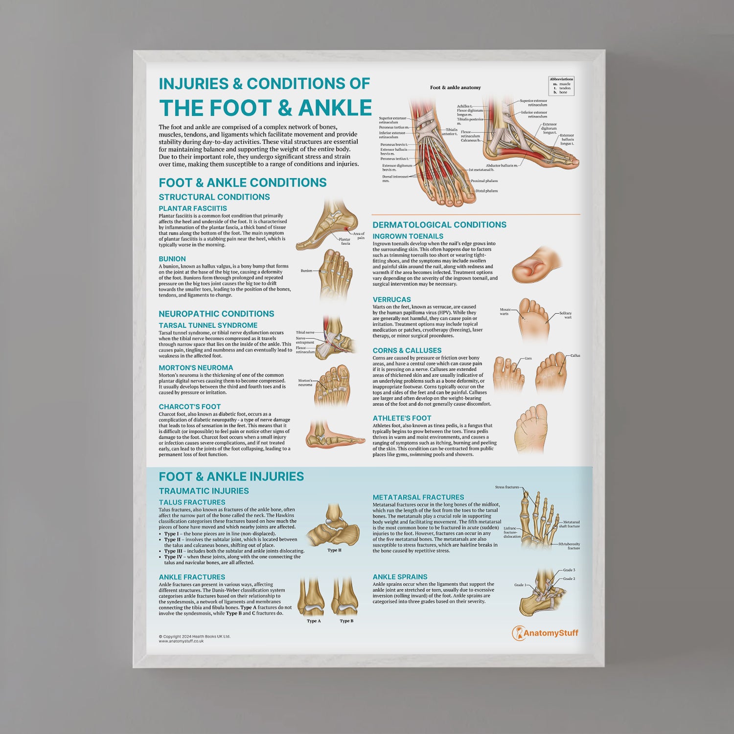 Injuries & Conditions of the Foot & Ankle Chart / Poster