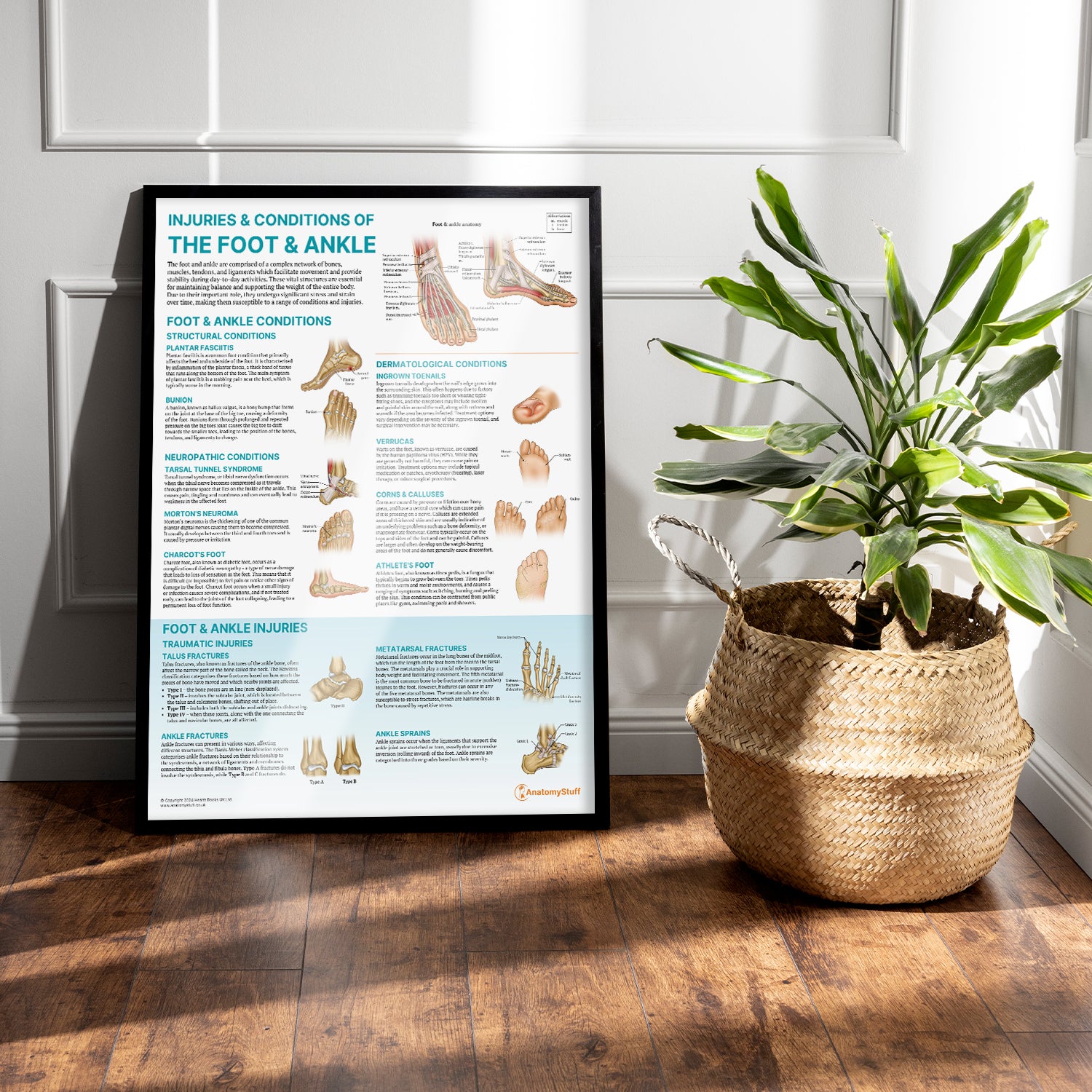 Injuries & Conditions of the Foot & Ankle Chart / Poster