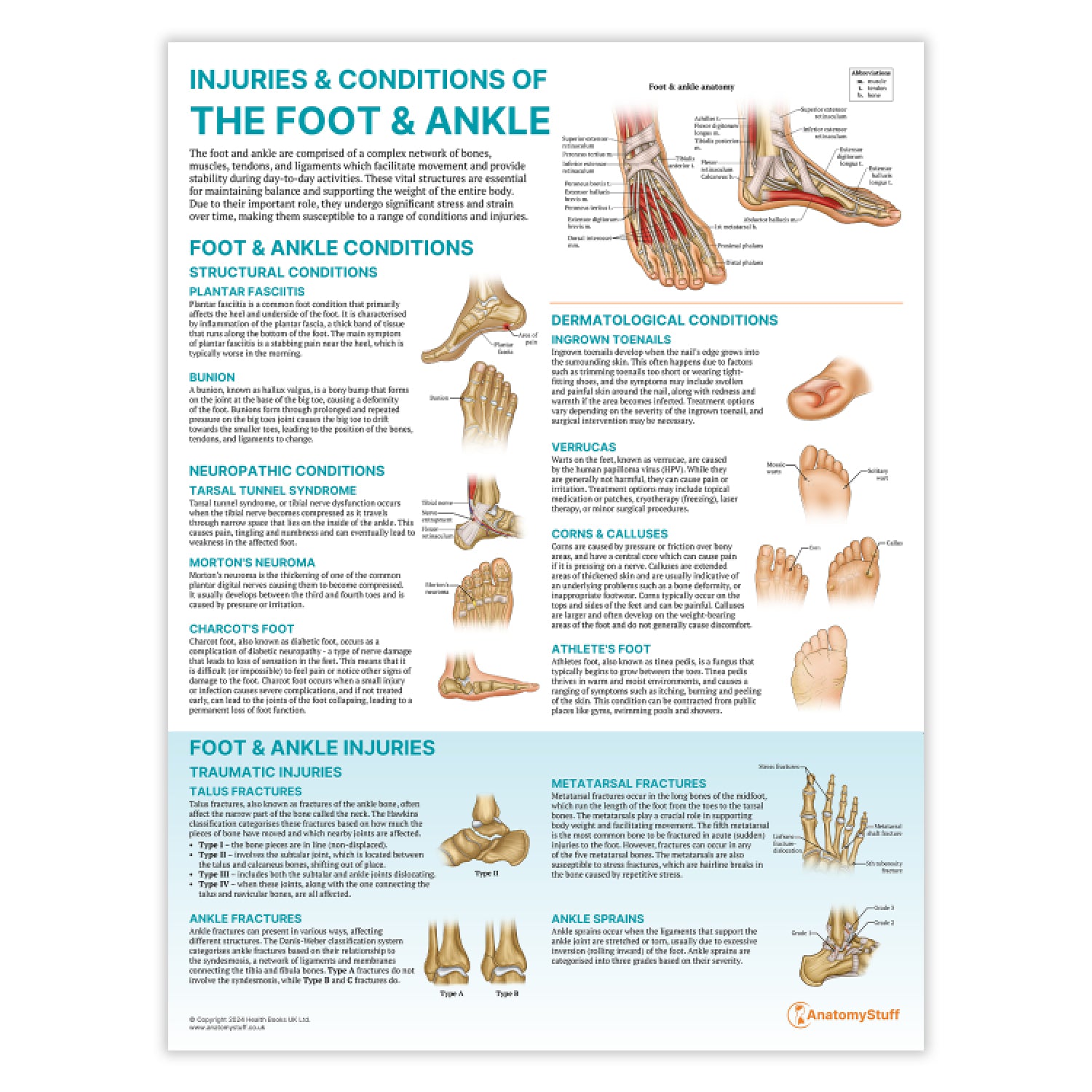 Injuries & Conditions of the Foot & Ankle Chart / Poster