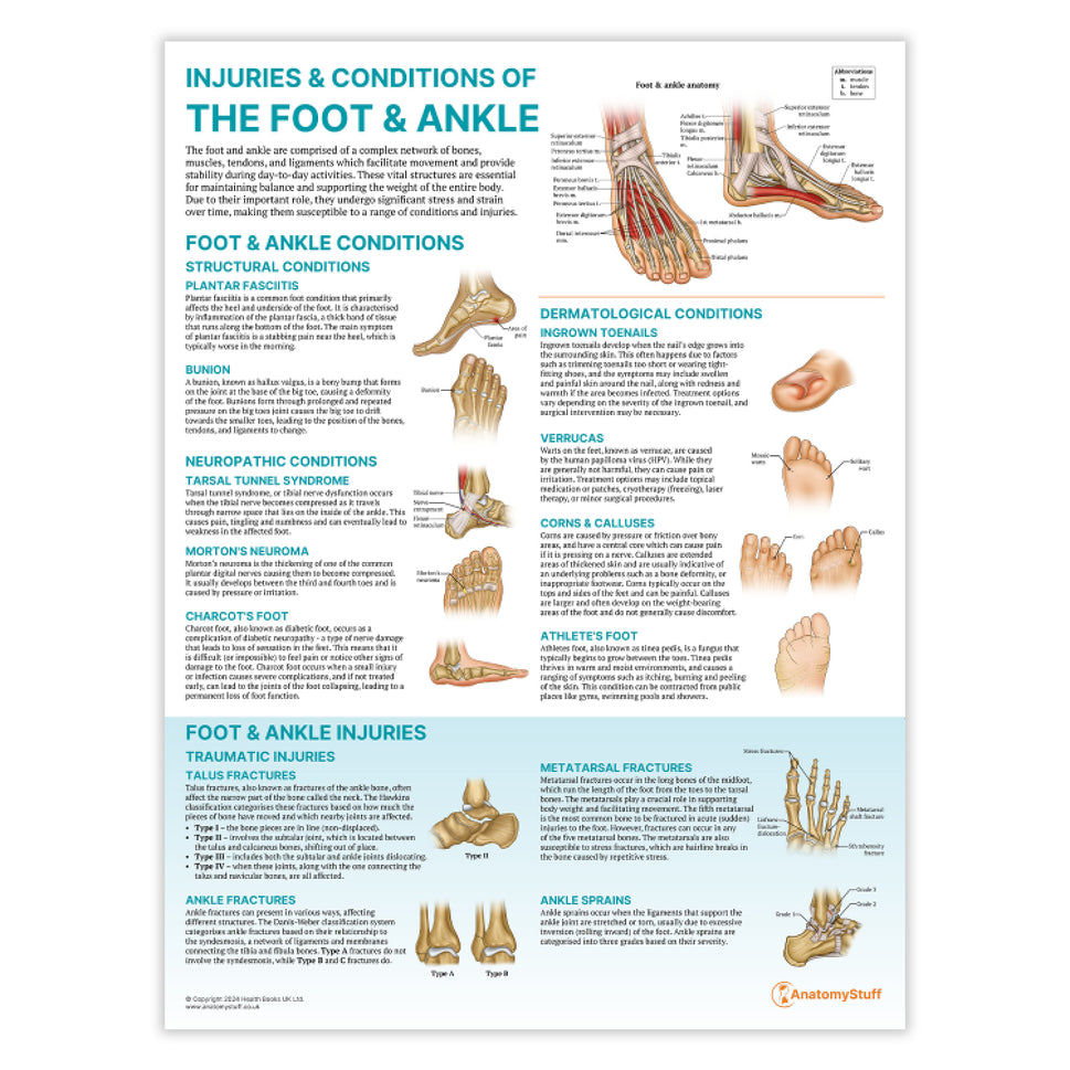 Injuries & Conditions of the Foot & Ankle Chart / Poster