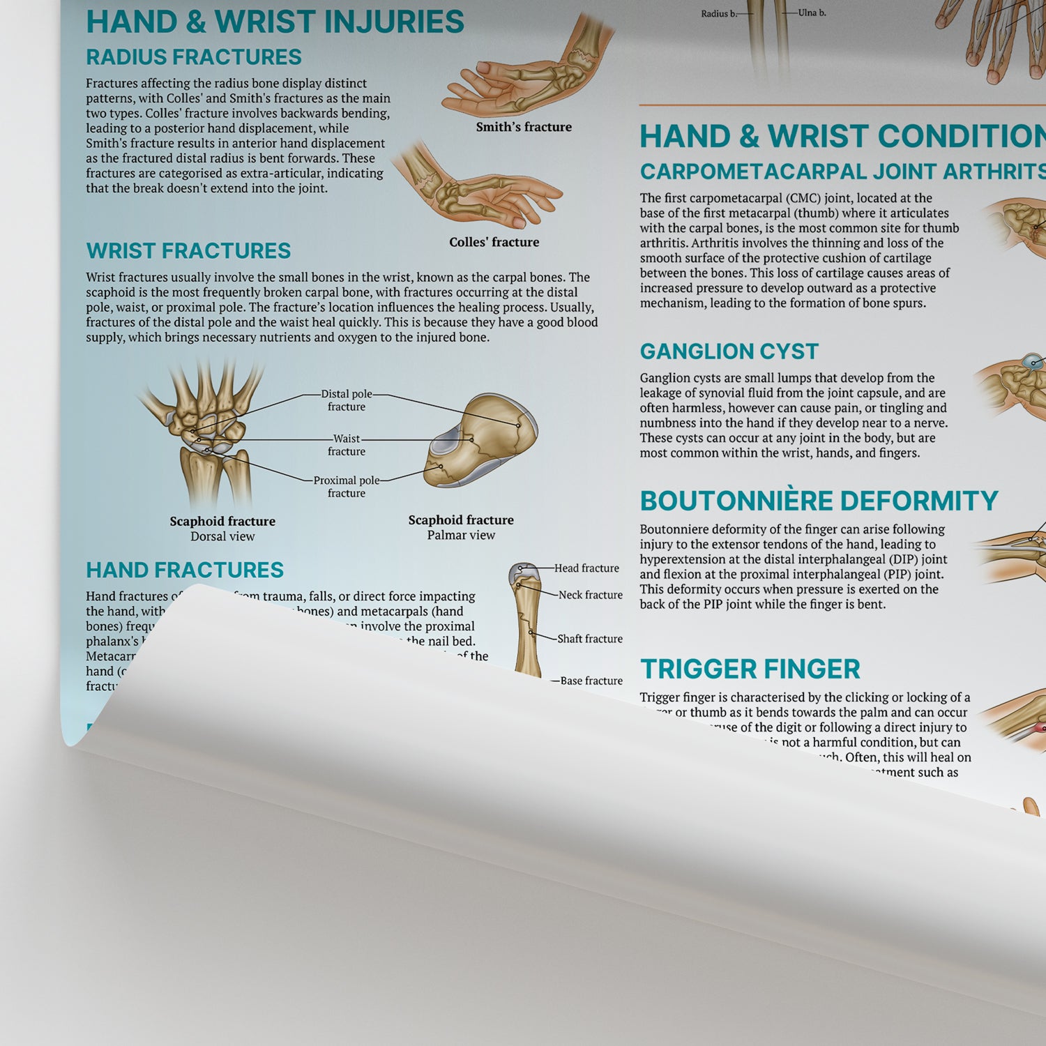 Injuries & Conditions of the Hand & Wrist Chart / Poster