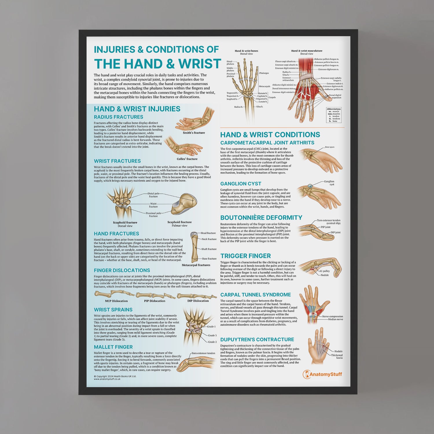 Injuries & Conditions of the Hand & Wrist Chart / Poster