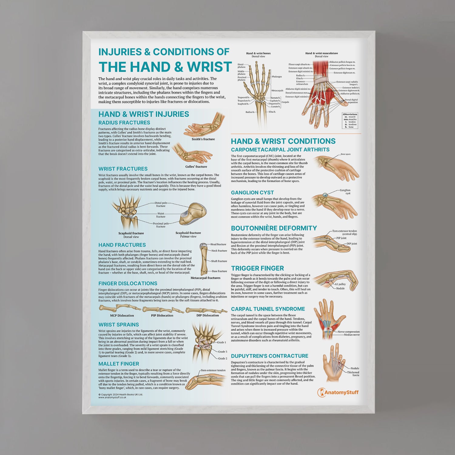 Injuries & Conditions of the Hand & Wrist Chart / Poster