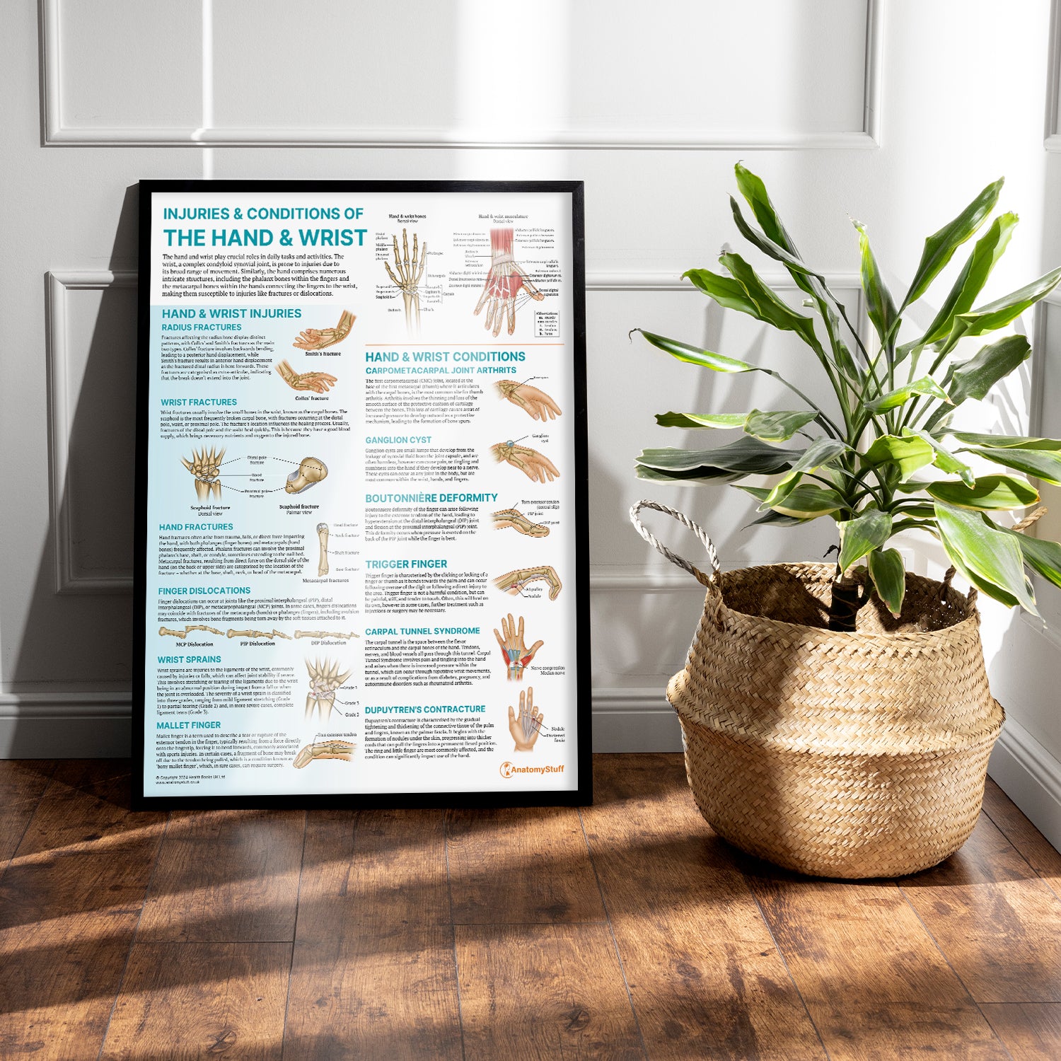 Injuries & Conditions of the Hand & Wrist Chart / Poster