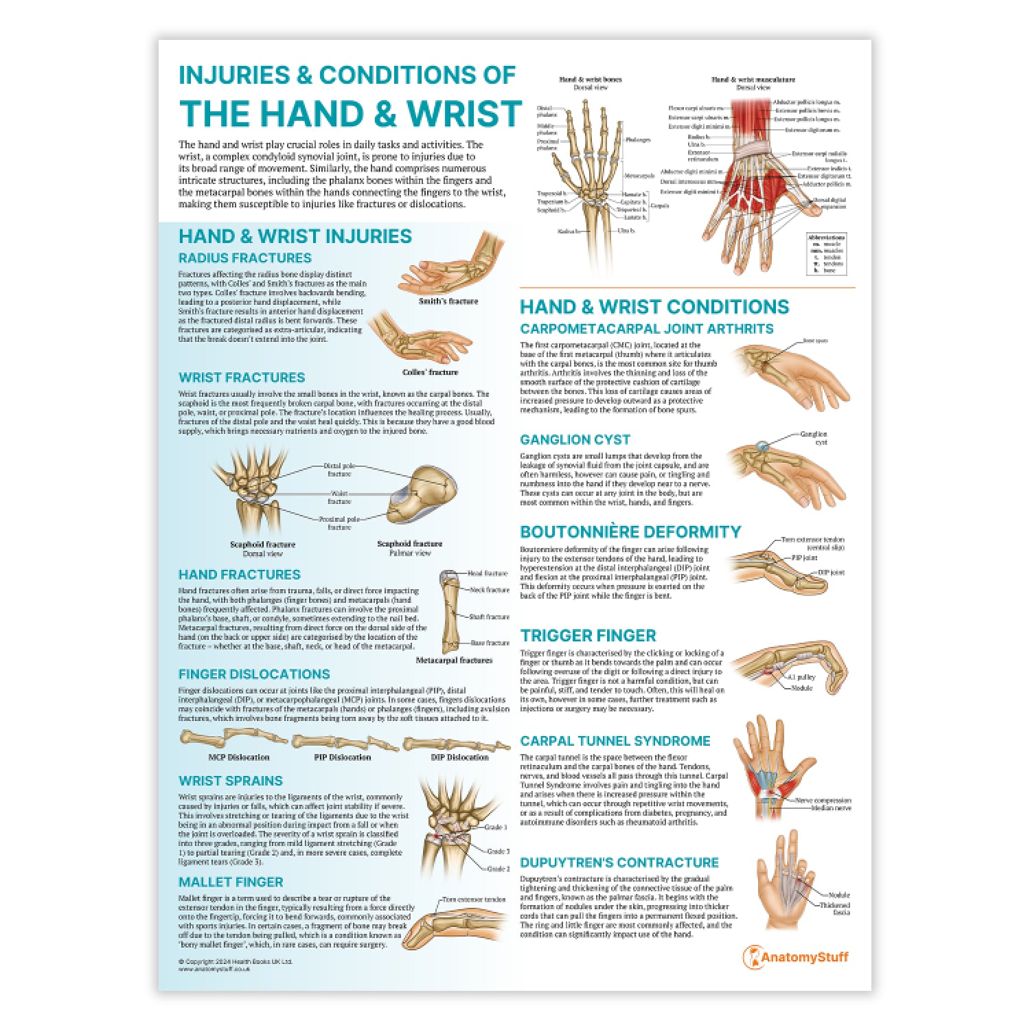 Injuries & Conditions of the Hand & Wrist Chart / Poster
