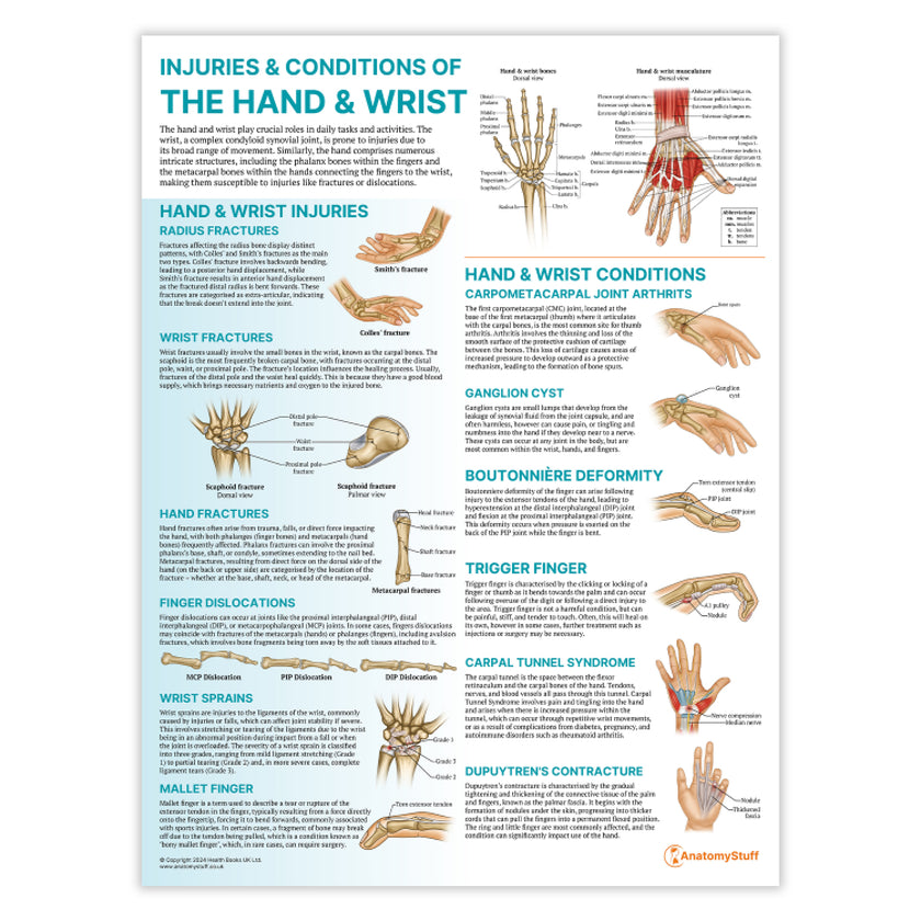 Injuries & Conditions of the Hand & Wrist Chart / Poster