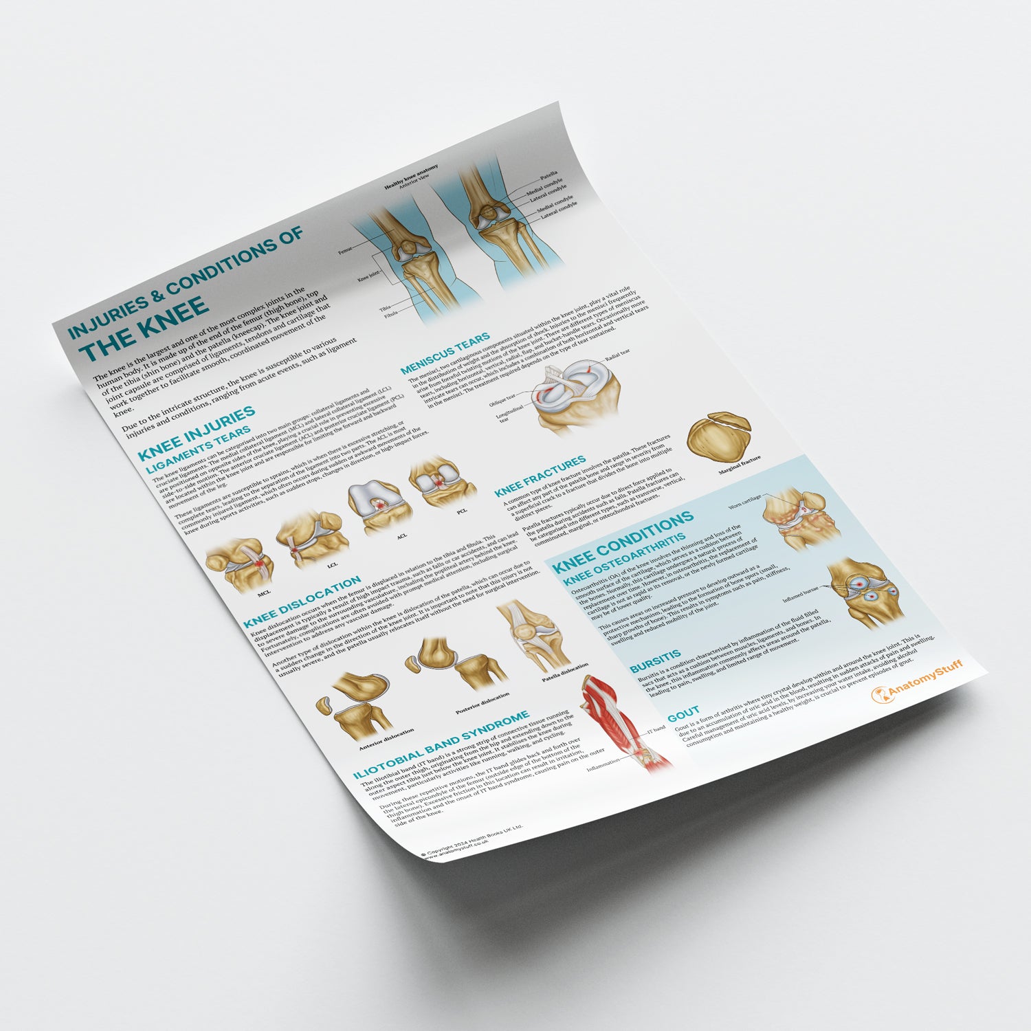 Injuries & Conditions of the Knee Chart / Poster