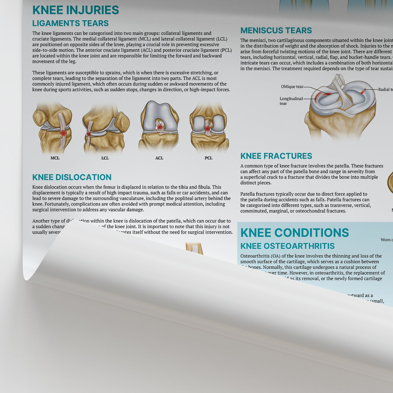 Injuries & Conditions of the Knee Chart / Poster