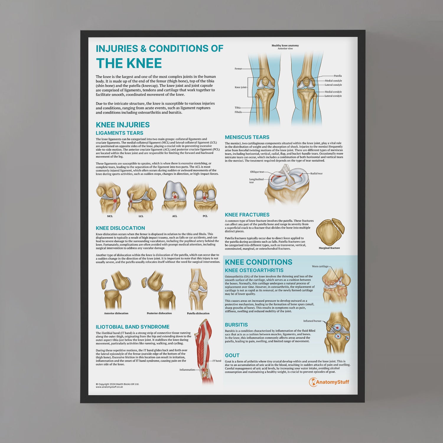 Injuries & Conditions of the Knee Chart / Poster