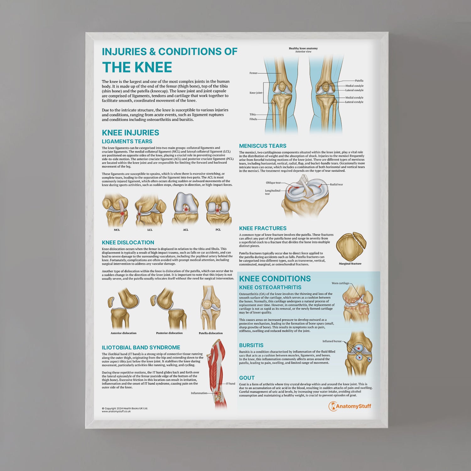 Injuries & Conditions of the Knee Chart / Poster