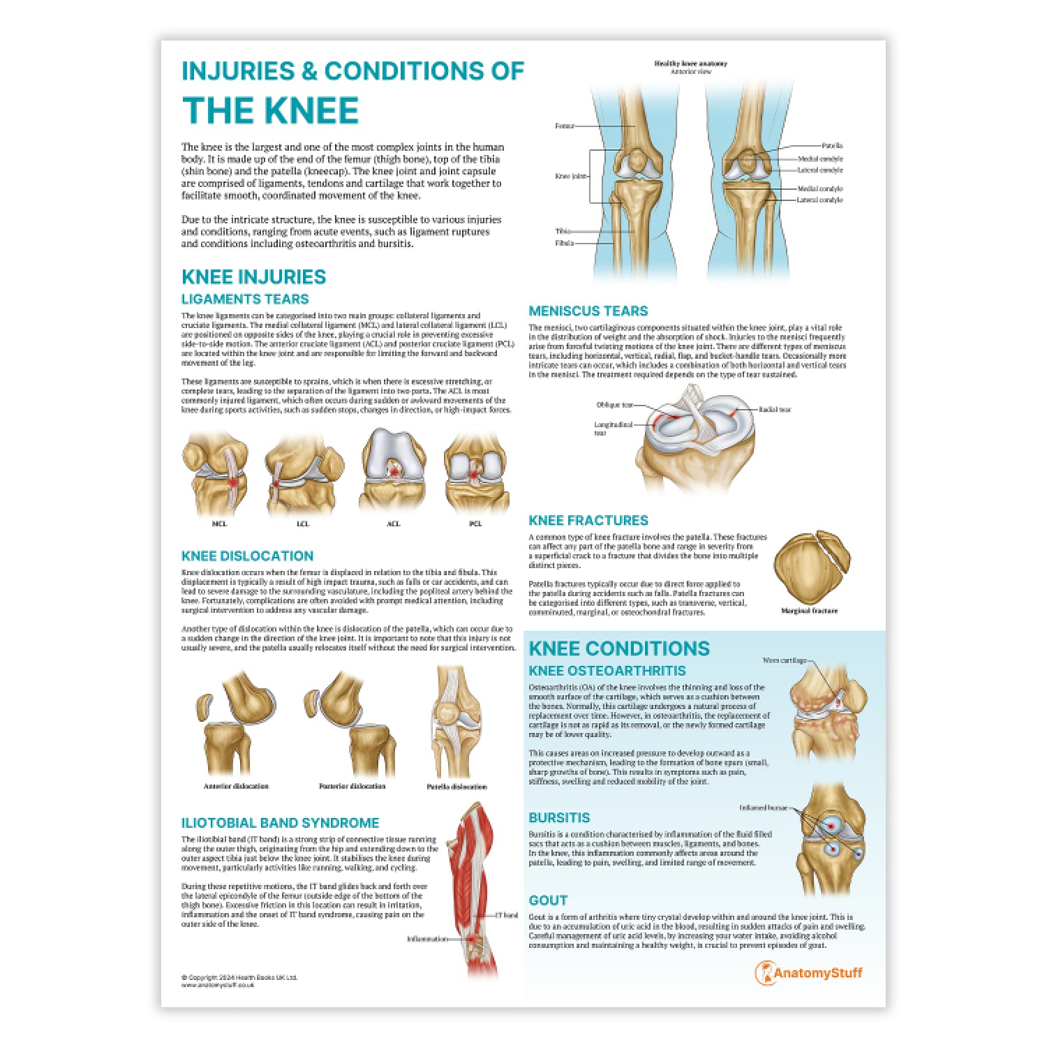 Injuries & Conditions of the Knee Chart / Poster