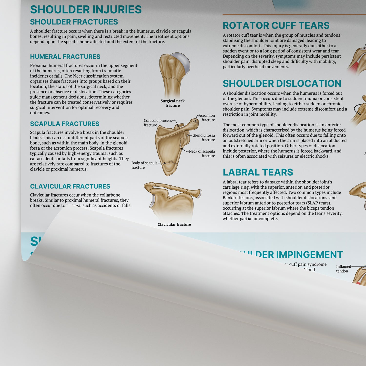 Injuries & Conditions of the Shoulder Chart / Poster