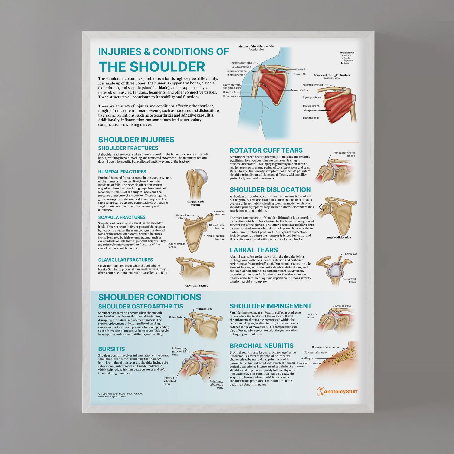 Injuries & Conditions of the Shoulder Chart / Poster