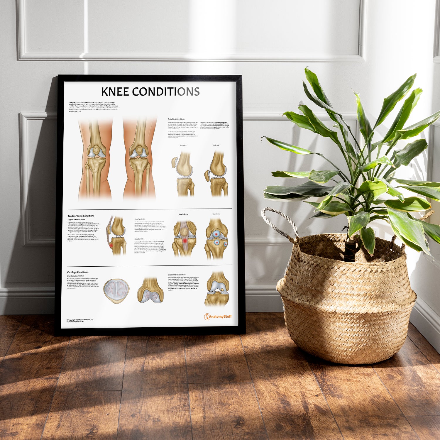Knee Conditions Chart / Poster