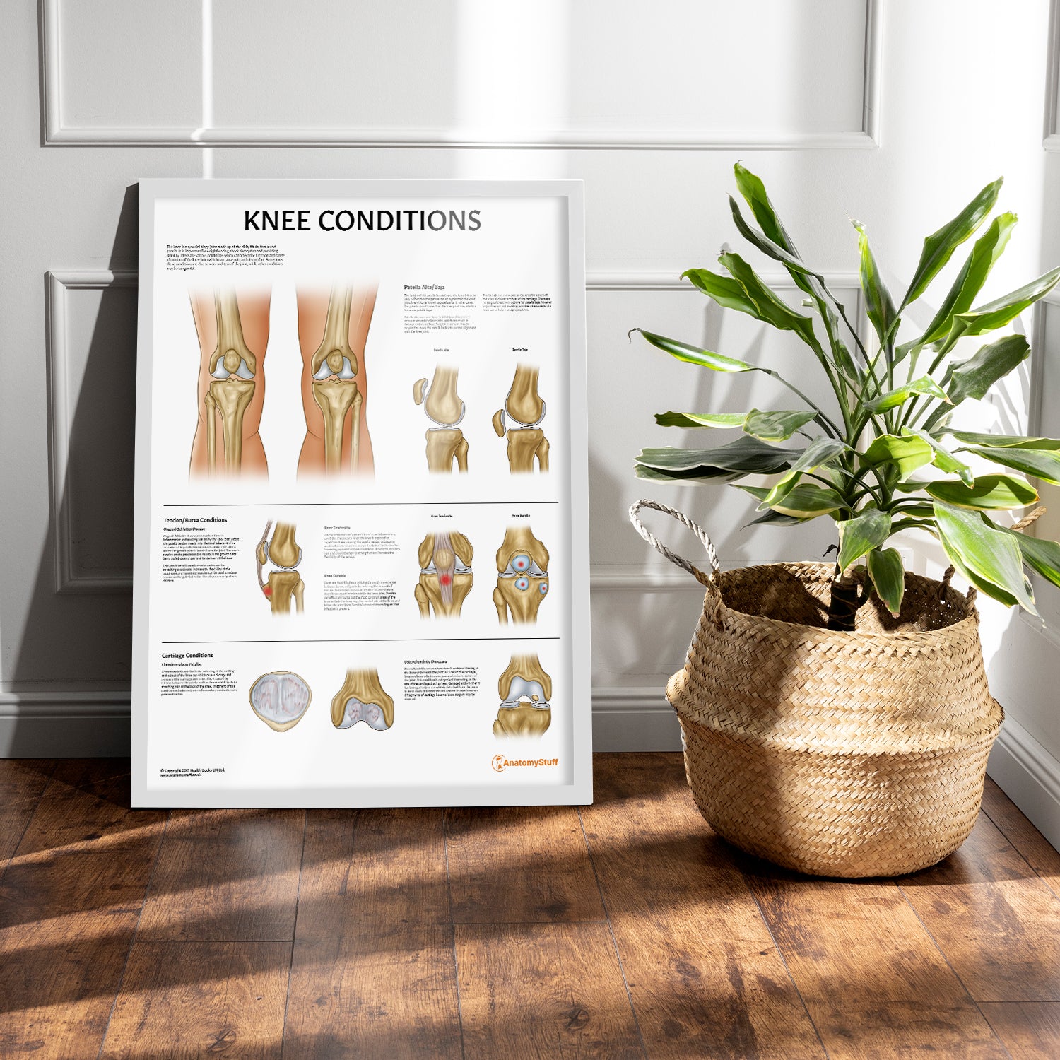 Knee Conditions Chart / Poster